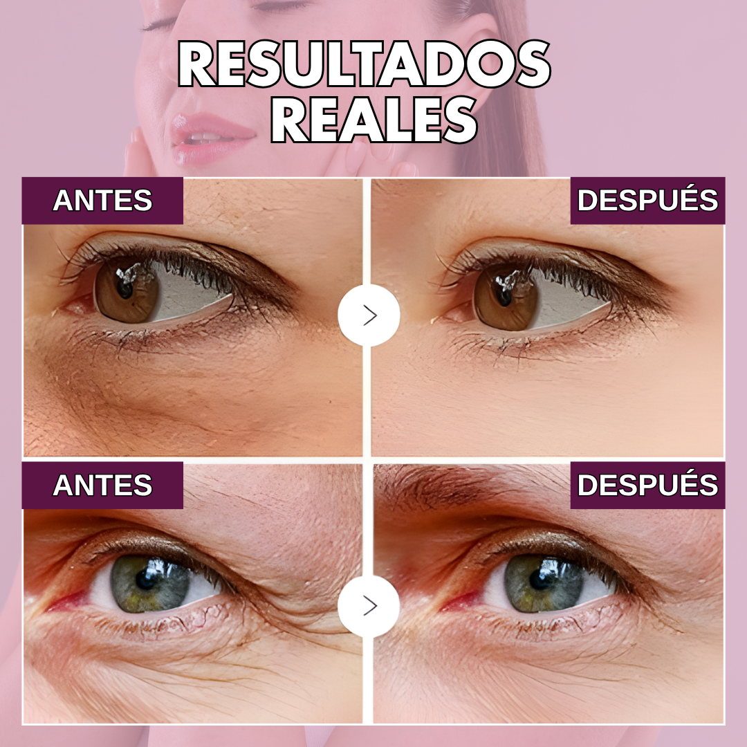 CalciumLift™ | Bálsamo Antiarrugas Instantáneo