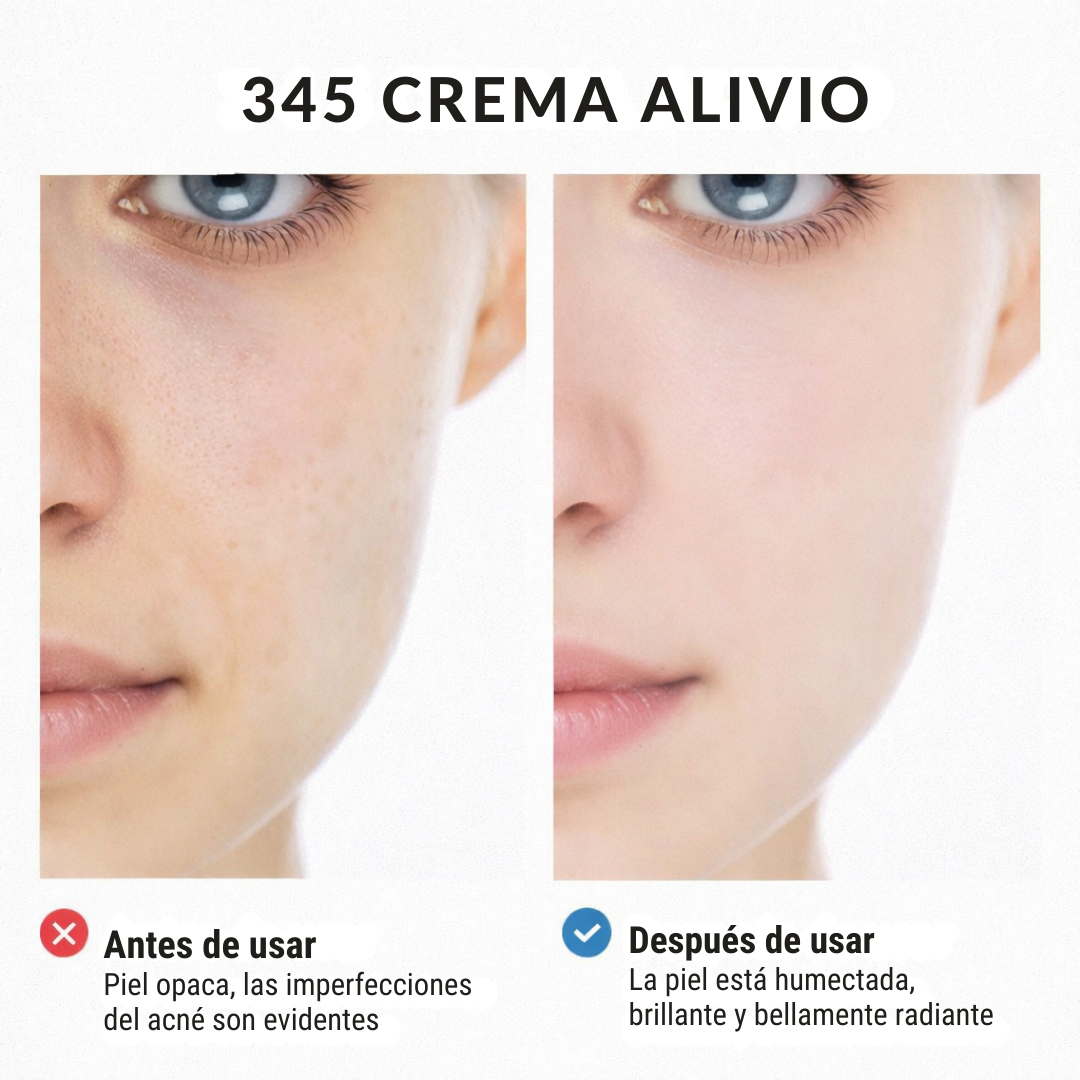 Relief 345 | Reafirmante facial con Ácido Hialurónico Regenerador