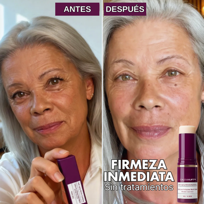 CalciumLift™ | Bálsamo Antiarrugas Instantáneo