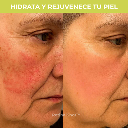RetinalShot: Potenciador Reafirmante Concentrado