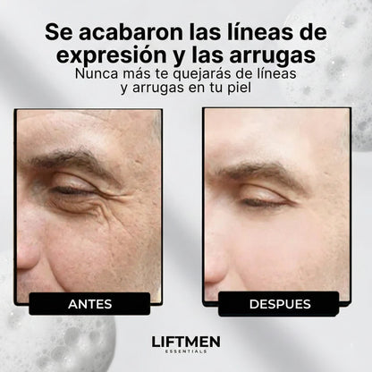 LiftMen™ – Bálsamo de Sebo Antiarrugas