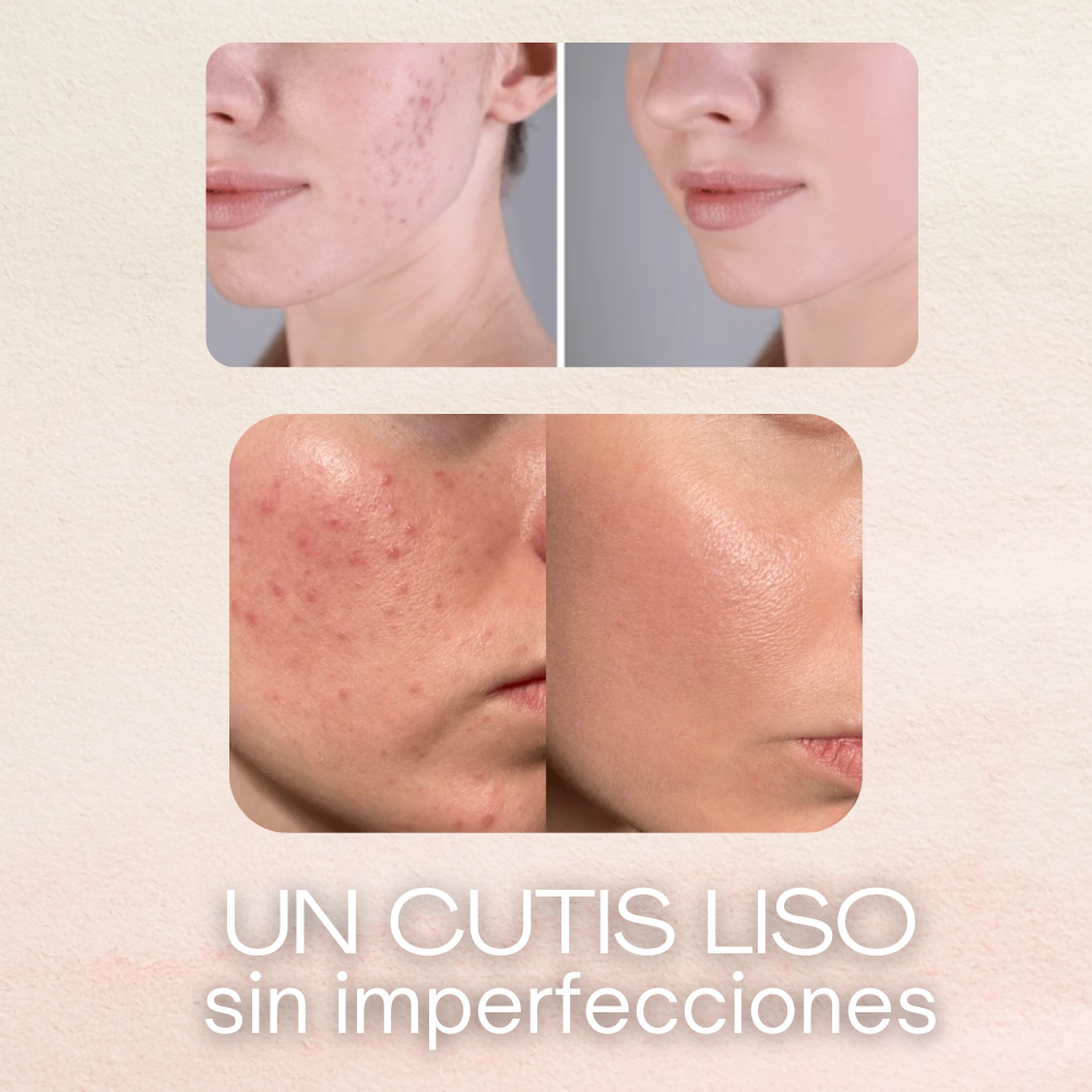 VitalCaps | Cápsulas de HA revitalizante antiedad