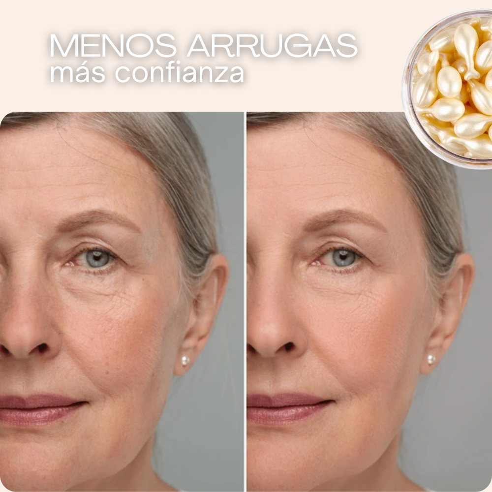 VitalCaps | Cápsulas de HA revitalizante antiedad