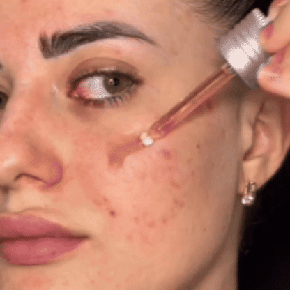 DermaRenew™ – Sérum Renovador con Retinol 0.3% y Niacinamida