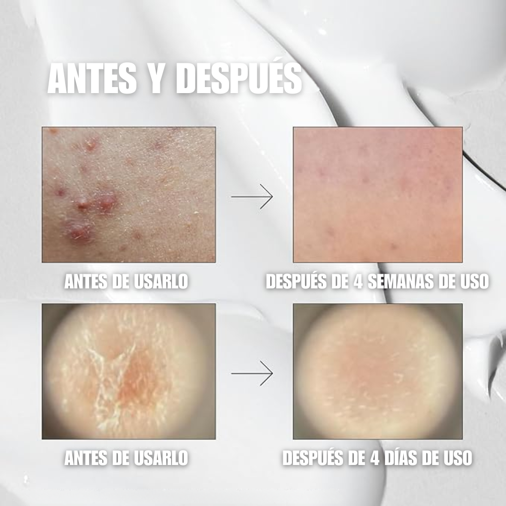 Reedle Shot 300:  Booster Bio-agujas Botánicas Coreana